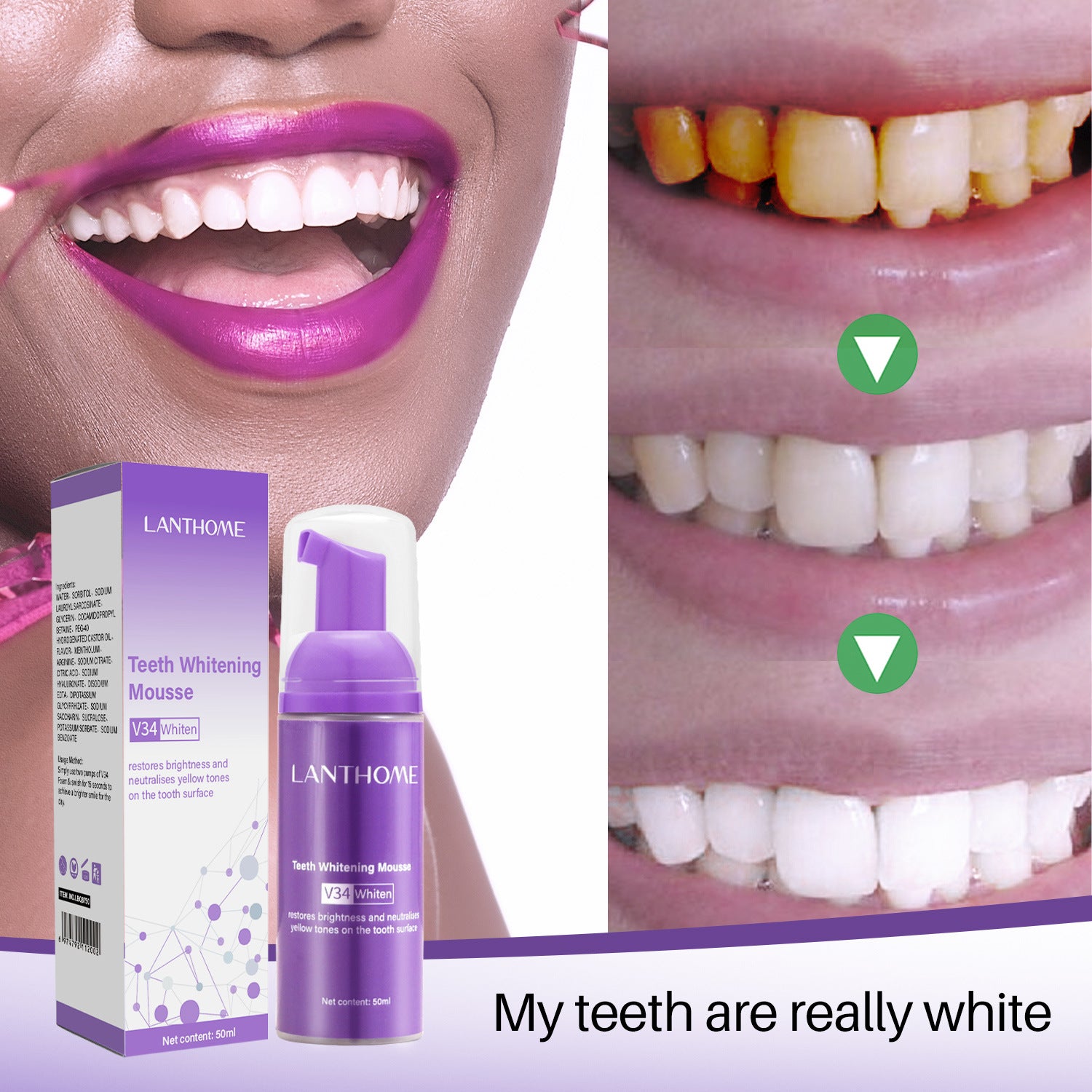 V34 Teeth Whitening Mousse